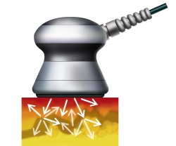 キャビテーション