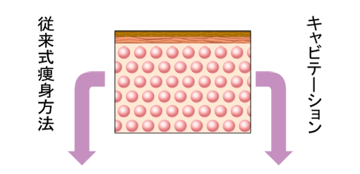 従来式痩身方法とキャビテーション