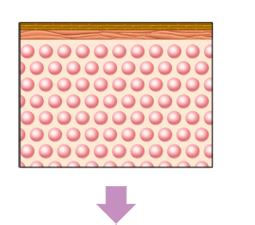 従来式痩身方法とキャビテーションの違い