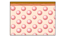 従来式痩身方法とキャビテーションの違い