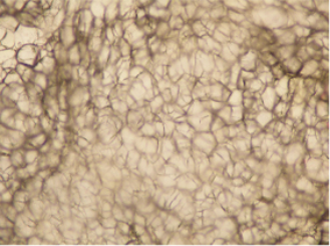 キャビテーションステップ１