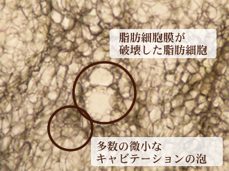 キャビテーションステップ２