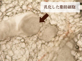 キャビテーションステップ４